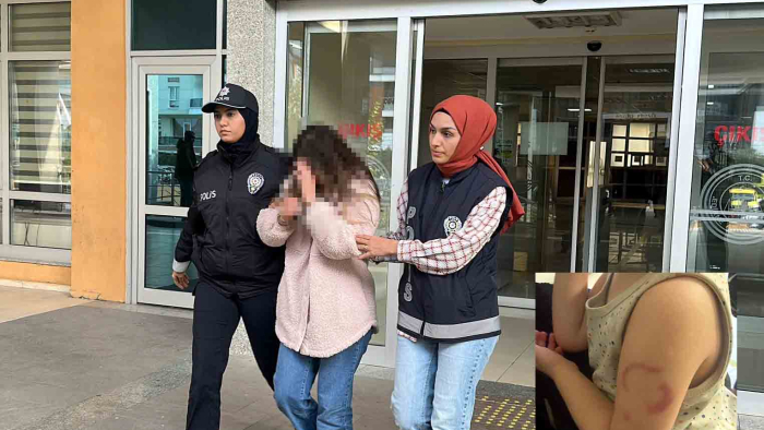 Bakımevinde 3 yaşındaki öğrencisinin kolunu ısıran öğretmen tutuklandı